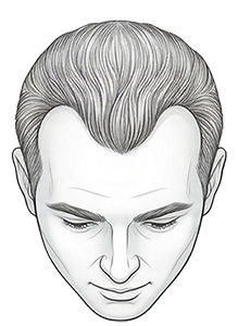 yourmed-nivel-de-calvice-3