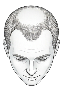 yourmed-nivel-de-calvice-4