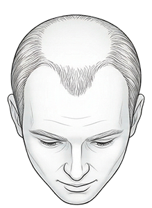 yourmed-nivel-de-calvice-5