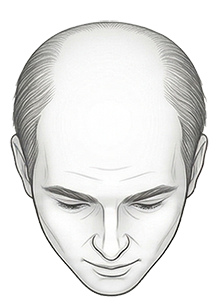 yourmed-nivel-de-calvice-6