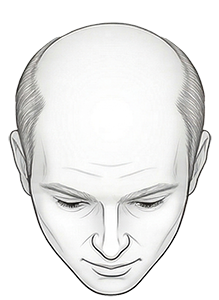 yourmed-nivel-de-calvice-7